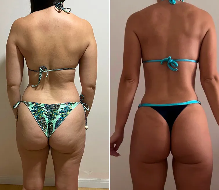 Antes e depois de aluno do protocolo